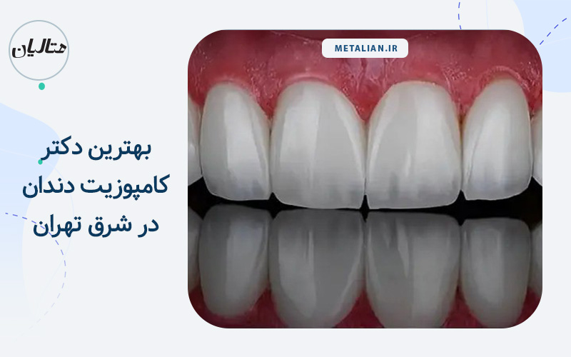 بهترین دکتر کامپوزیت دندان در شرق تهران