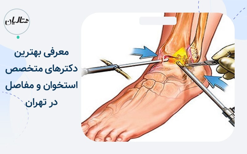 دکتر علیرضا میرزاصادقی معرفی بهترین دکترهای متخصص استخوان و مفاصل در تهران
