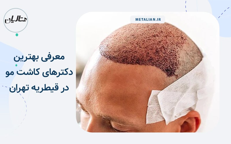 دکتر حامد منادی بهترین دکترهای متخصص کاشت مو در قیطریه تهران