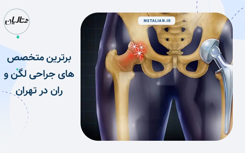 دکتر کاوه قرنی زاده برترین متخصص های جراحی لگن و ران در تهران