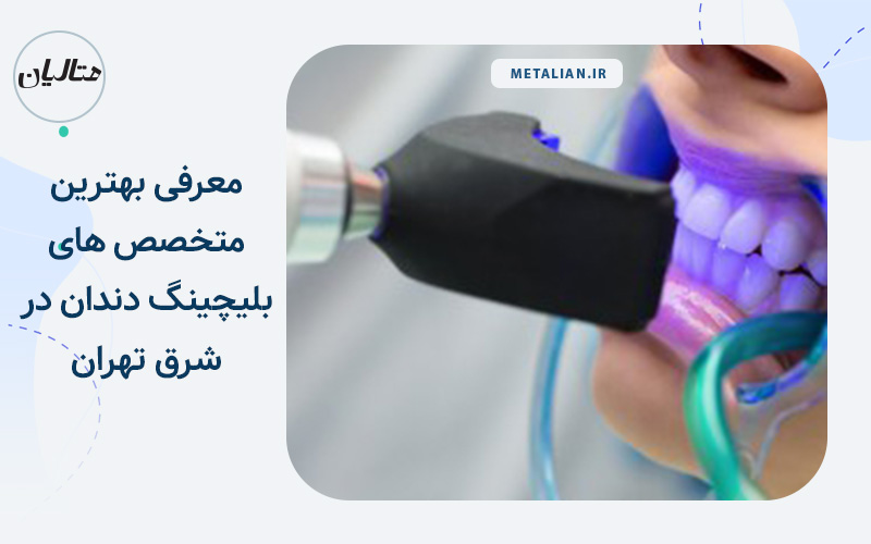 معرفی بهترین دکترهای متخصص بلیچینگ در شرق تهران