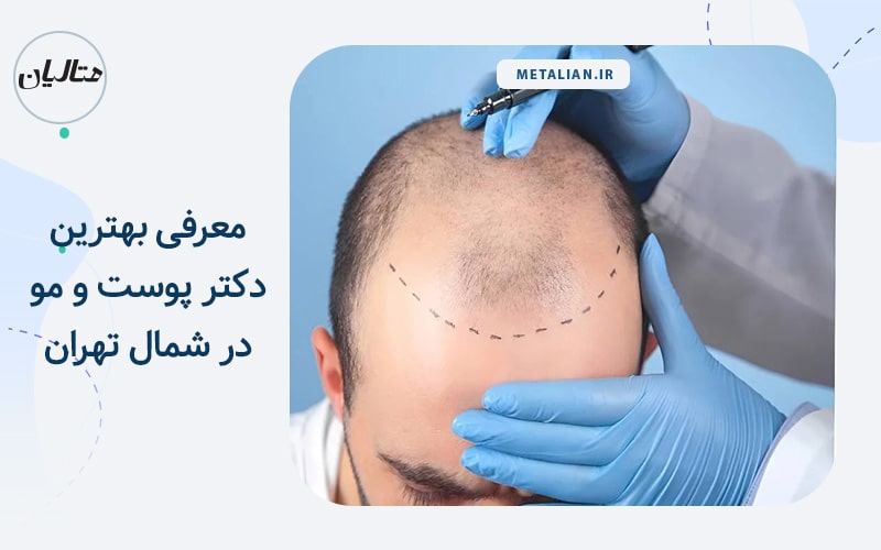 بهترین دکتر پوست و مو در شمال تهران