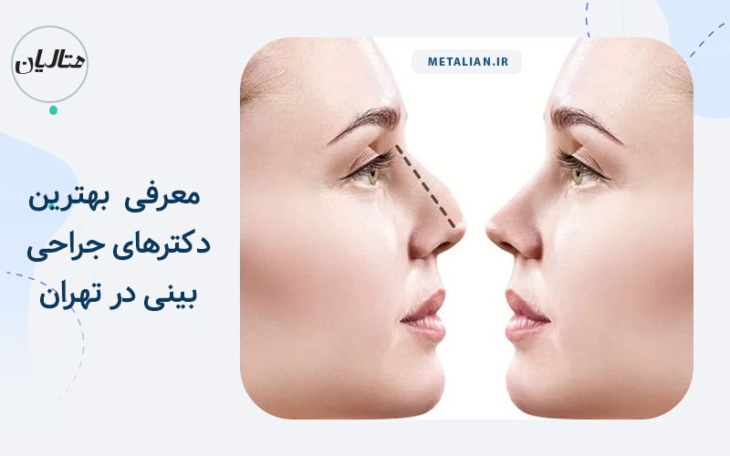 دکترهای جراحی بینی در تهران