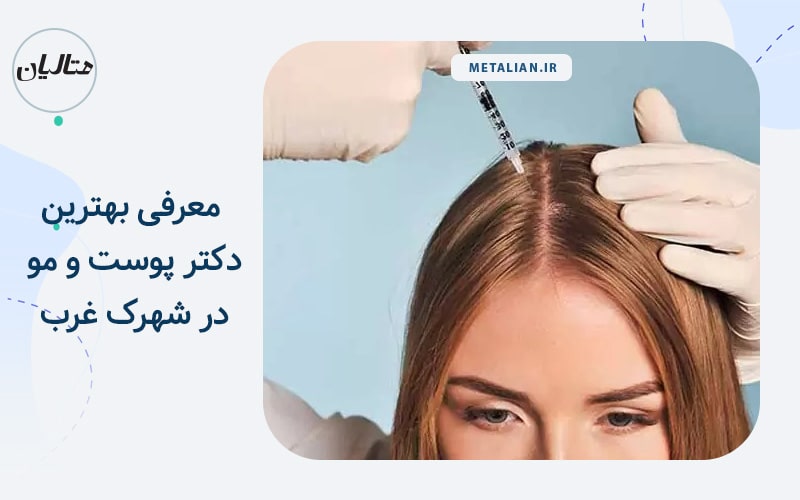 بهترین دکتر پوست و مو در شهرک غرب