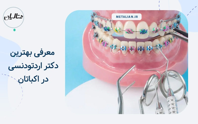 بهترین دکتر اردتودنسی در اکباتان