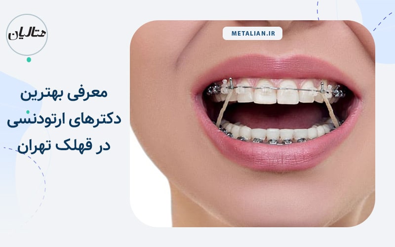 بهترین دکتر ارتودنسی در قهلک تهران