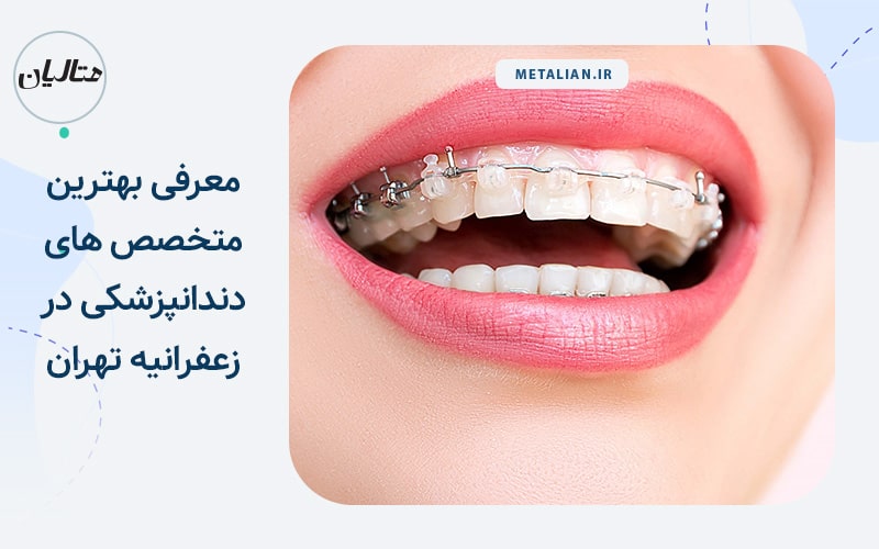 بهترین متخصص ارتودنسی در زعفرانیه