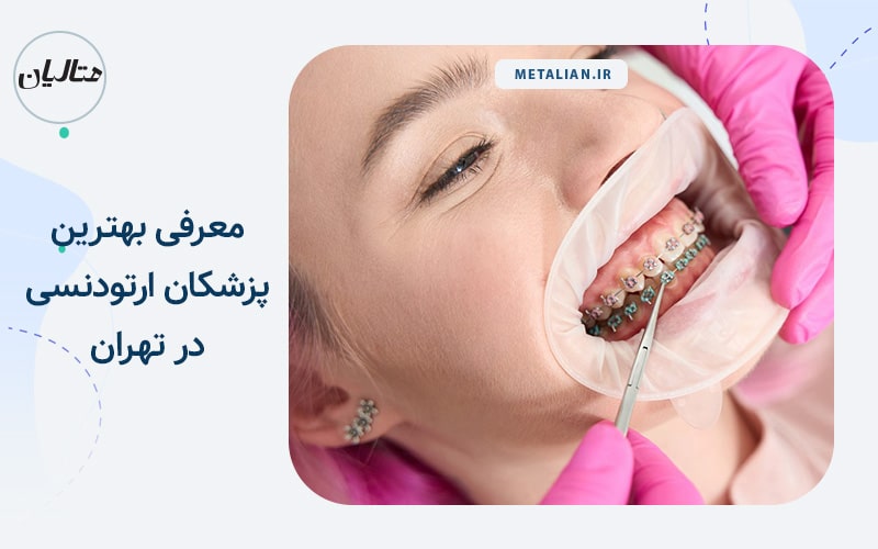 بهترین دکتر ارتودنسی در تهران