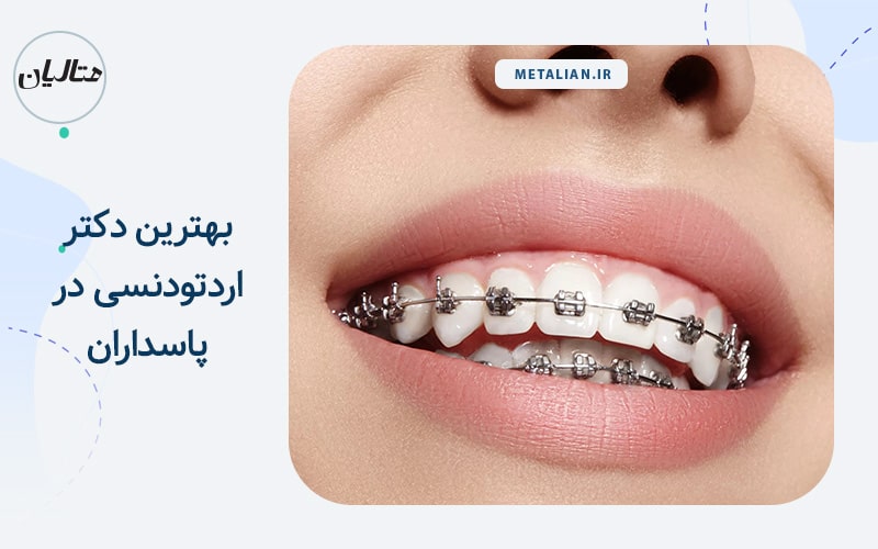 بهترین دکتر ارتودنسی در پاسداران تهران