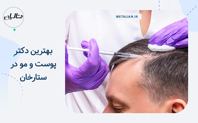 بهترین دکتر پوست و مو در ستارخان