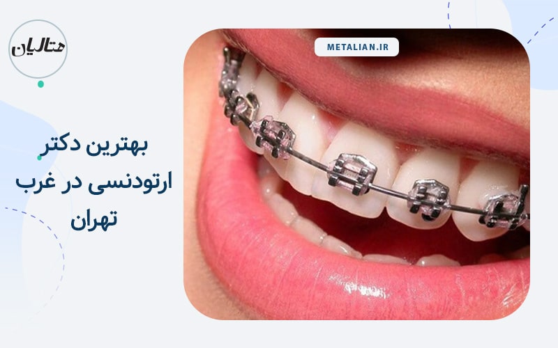 بهترین دکتر ارتودنسی در غرب تهران