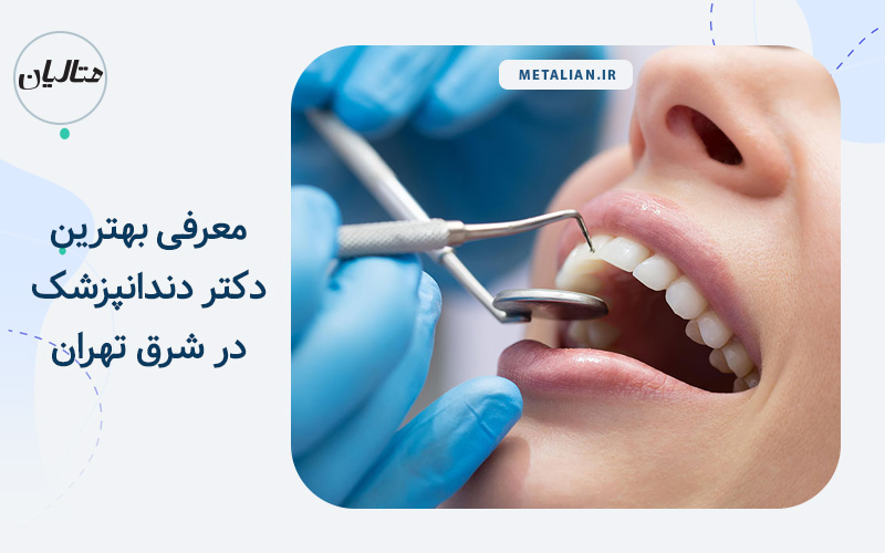 معرفی بهترین دکتر دندانپزشک در شرق تهران