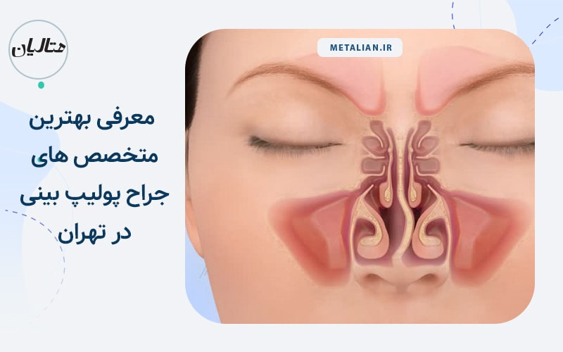 دکتر علی ابراهیمی معرفی بهترین متخصص های جراح پولیپ بینی در تهران