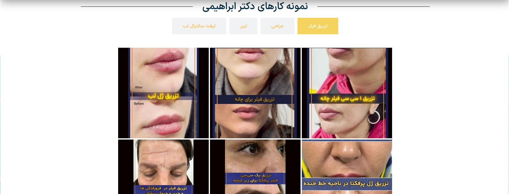 دکتر علی ابراهیمی معرفی بهترین متخصص های جراح پولیپ بینی در تهران