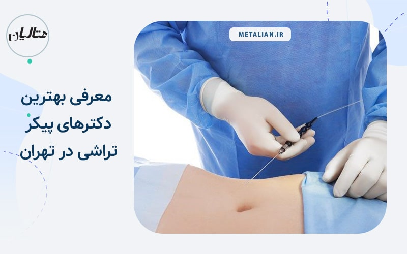 دکتر عطاالله حیدری معرفی بهترین دکترهای پیکرتراشی در تهران