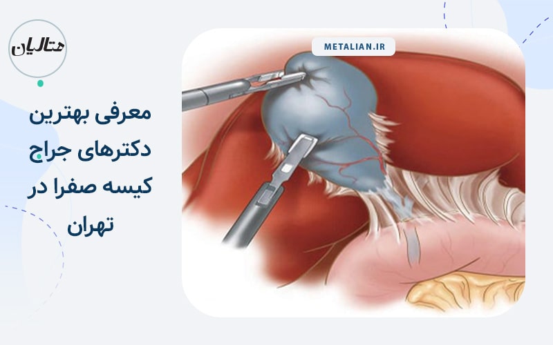 دکتر مازیار فریدی برترین متخصص های لاپاراسکوپی در تهران