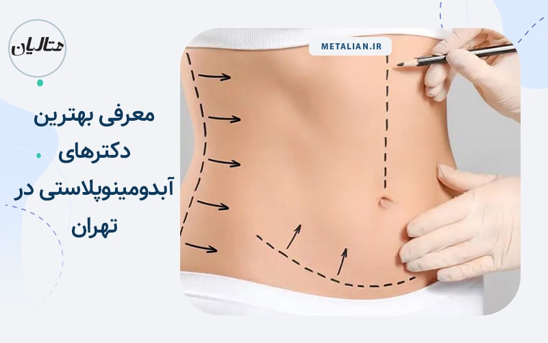 معرفی بهترین دکترهای آبدومینوپلاستی در تهران