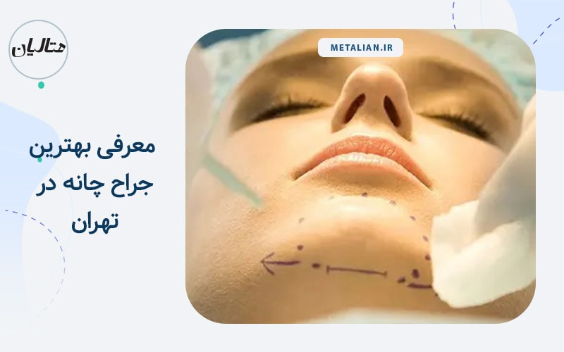 معرفی بهترین جراح چانه در تهران
