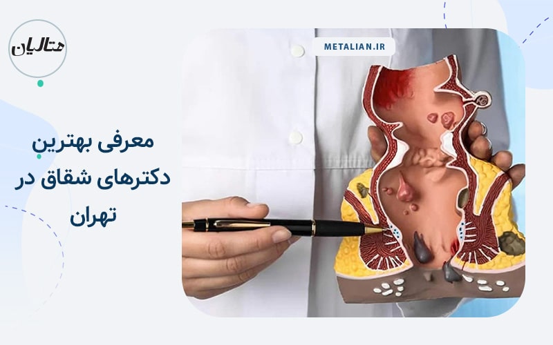 معرفی بهترین دکترهای شقاق در تهران