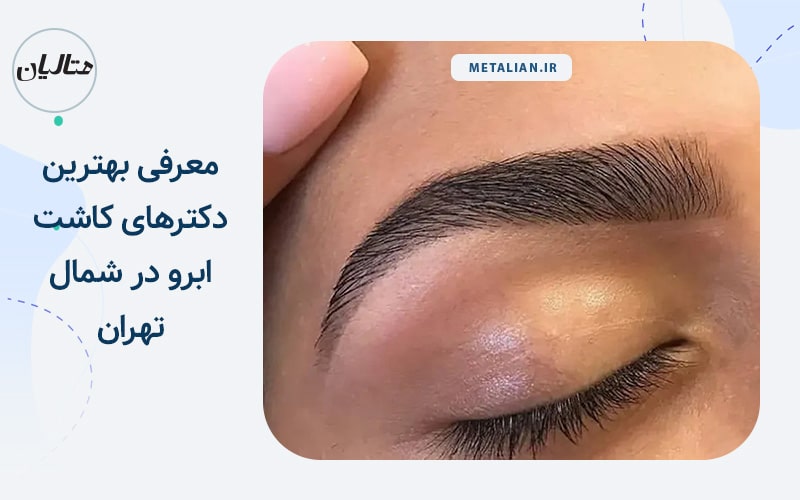 معرفی بهترین دکترهای کاشت ابرو در شمال تهران
