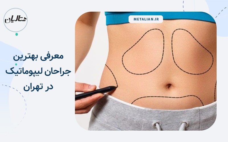 معرفی بهترین جراحان لیپوماتیک در تهران