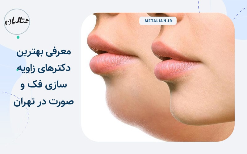 معرفی بهترین دکترهای زاویه سازی فک و صورت در تهران