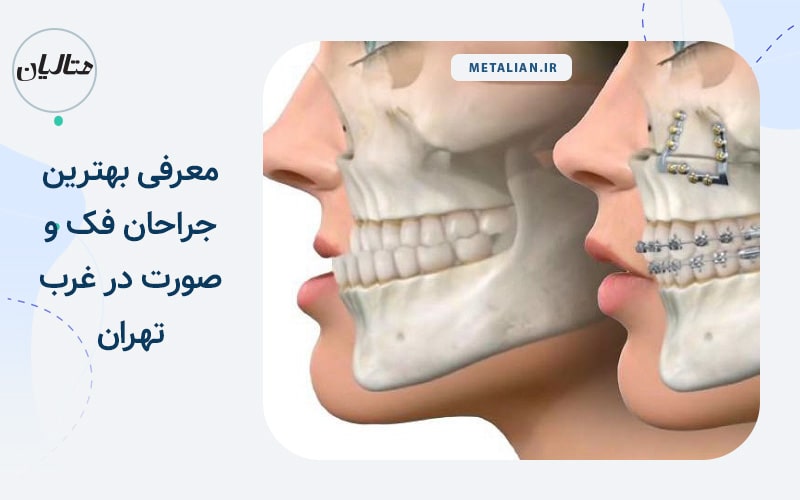 معرفی بهترین جراحان فک و صورت در غرب تهران