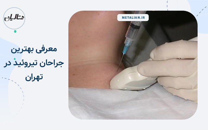 معرفی بهترین جراحان تیروئید در تهران