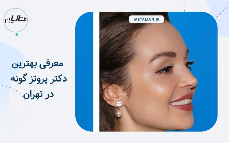 بهترین دکتر پروتز گونه در تهران