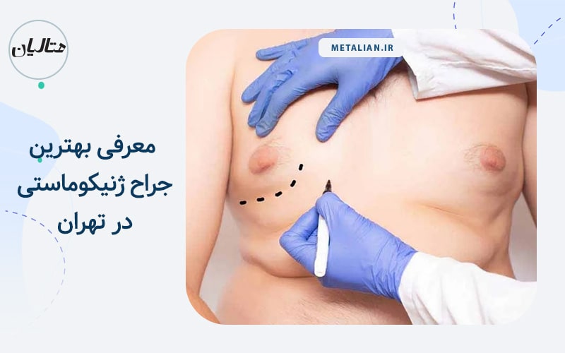 بهترین جراح ژنیکوماستی در تهران