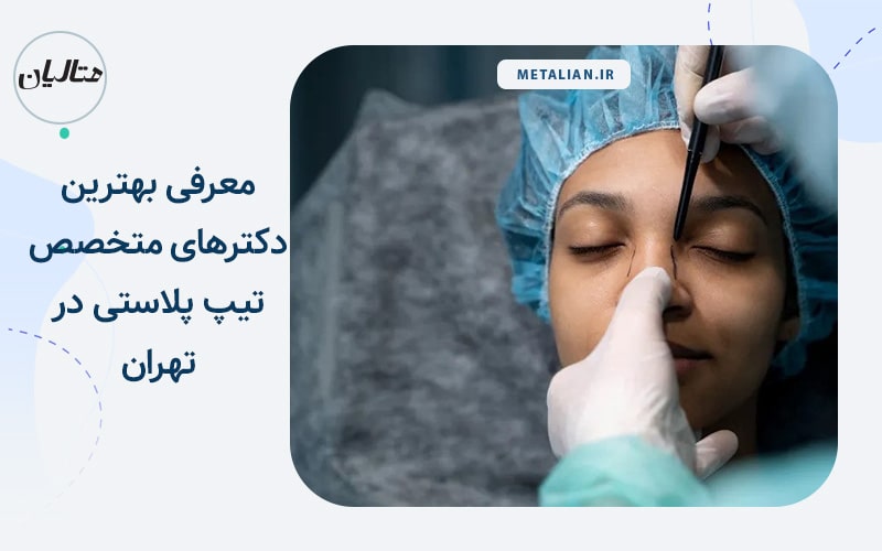 معرفی بهترین متخصص های تیپ پلاستی در تهران