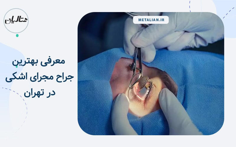 بهترین جراح مجرای اشکی در تهران
