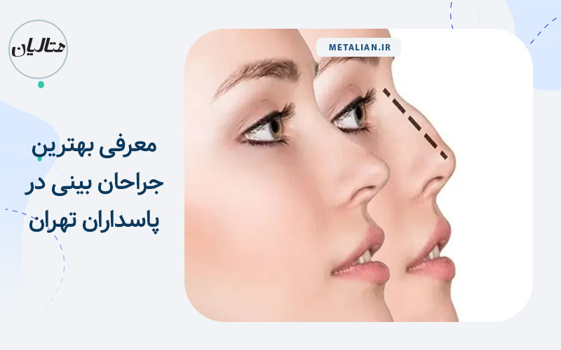معرفی بهترین جراحان بینی در پاسداران تهران