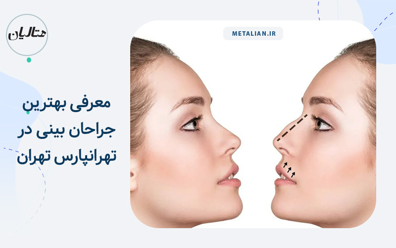 معرفی بهترین جراحان بینی در تهرانپارس تهران