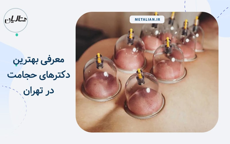 معرفی بهترین دکترهای حجامت در تهران