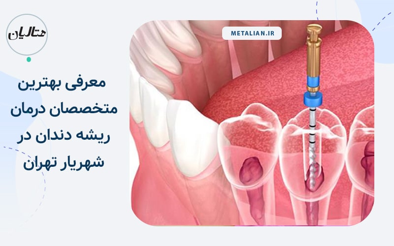 دکتر رضا وفادوست معرفی بهترین متخصصان درمان ریشه دندان در شهریار تهران