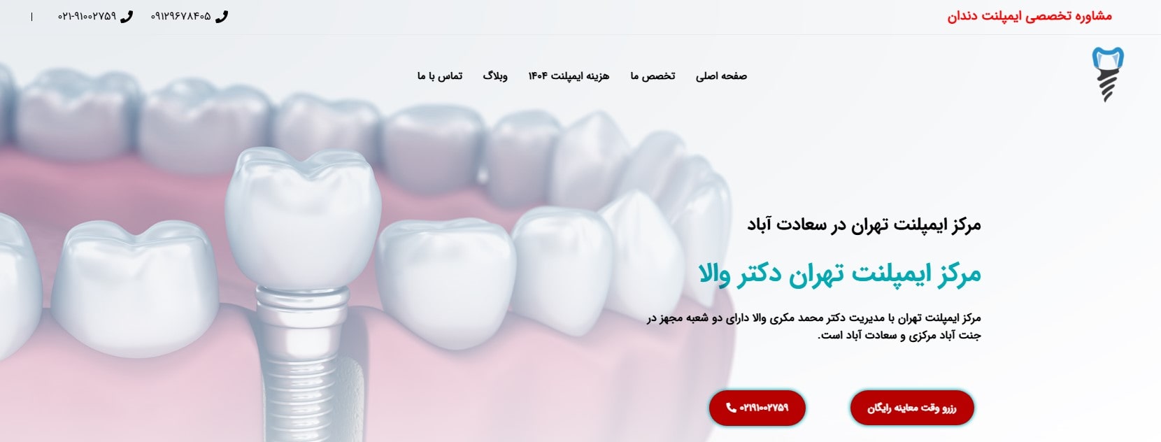 مرکز ایمپلنت دکتر والا بهترین مراکز ایمپلنت در شهرک غرب تهران