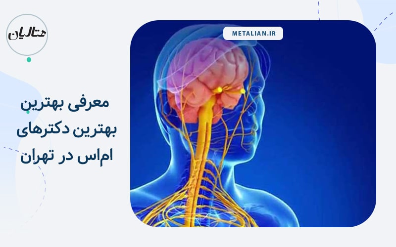 بهترین دکترهای ام‌اس در تهران