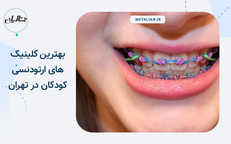 بهترین کلینیک های ارتودنسی کودکان در تهران