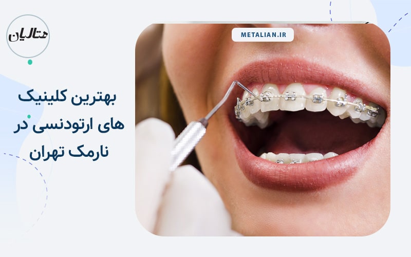کلینیک دندانپزشکی لبخند سپید بهترین کلینیک های ارتودنسی در نارمک تهران