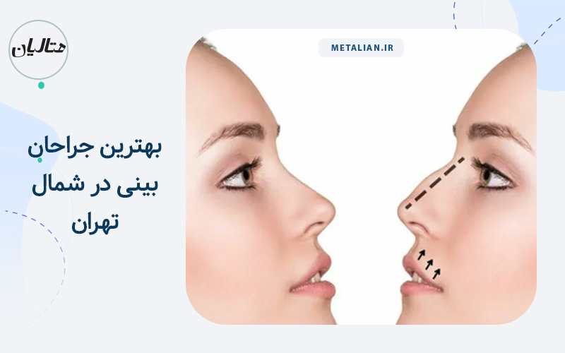 بهترین جراحان بینی در شمال تهران