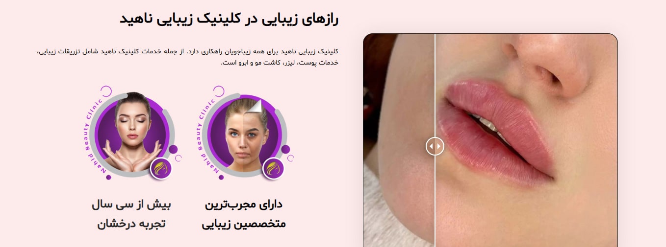 کلینیک زیبایی ناهید بهترین کلینیک لیزر در منیریه در تهران