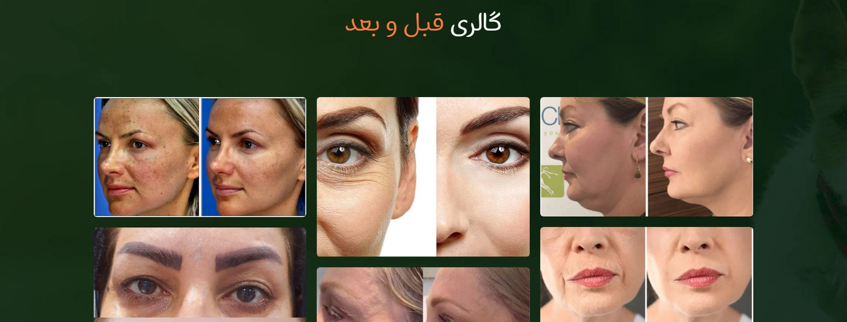 کلینیک تخصصی پوست و مو سیب سبز بهترین کلینیک های درمان ترک پوستی در تهران