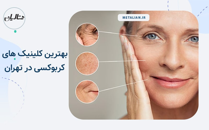 بهترین کلینیک های کربوکسی در تهران