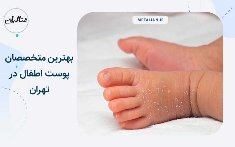 بهترین متخصصان پوست اطفال در تهران